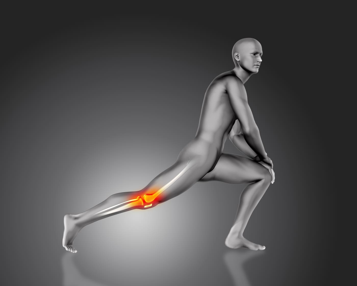 RA is not just pain