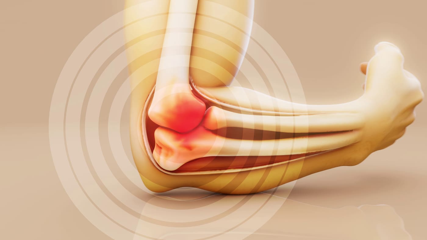 RA is not just pain