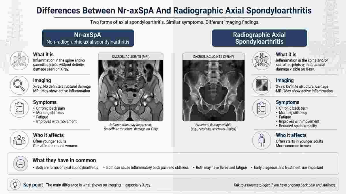 Differences Between Nr-axSpA And Radiographic Axial Spondyloarthritis
