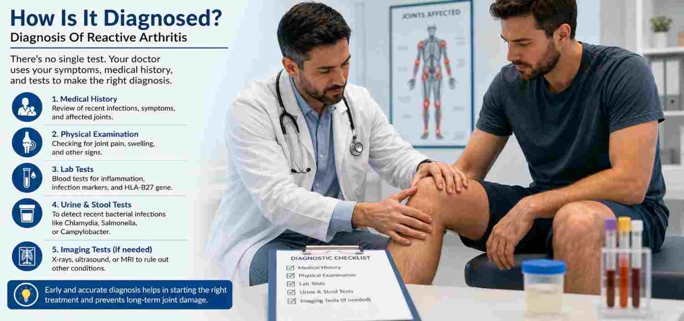 How Is It Diagnosed? Diagnosis Of Reactive Arthritis
