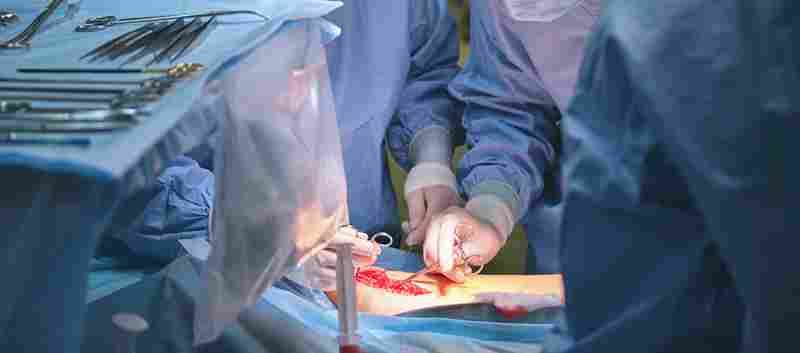 Surgical Options