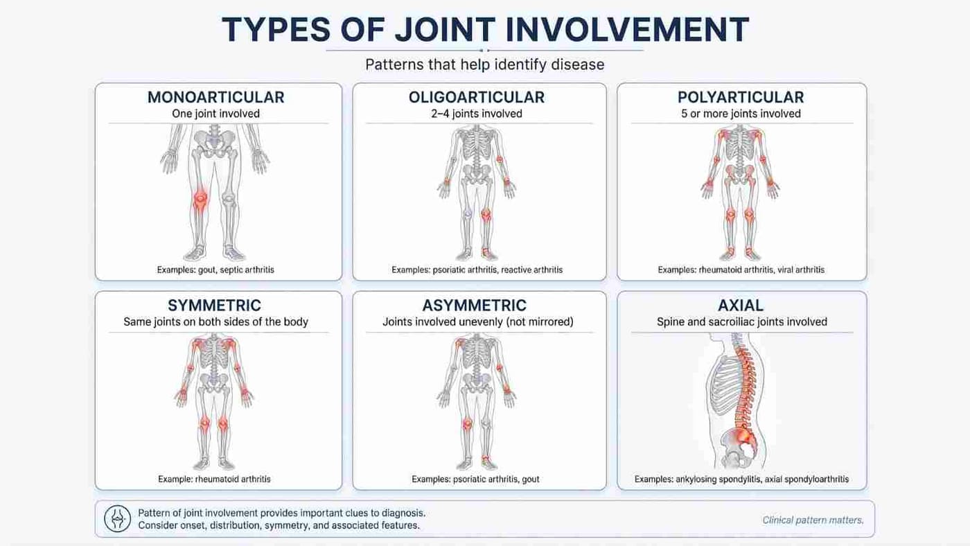 Types Of Joint Involvement
