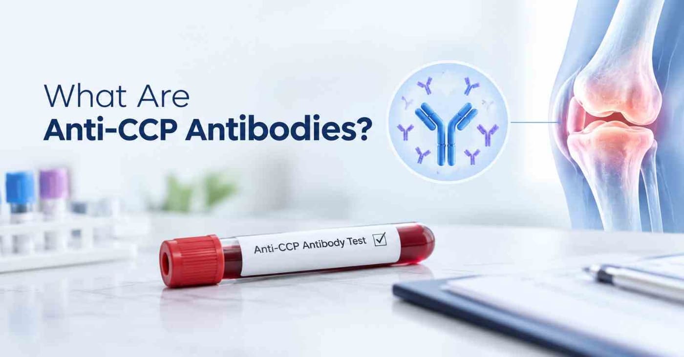 What Are Anti-CCP Antibodies?
