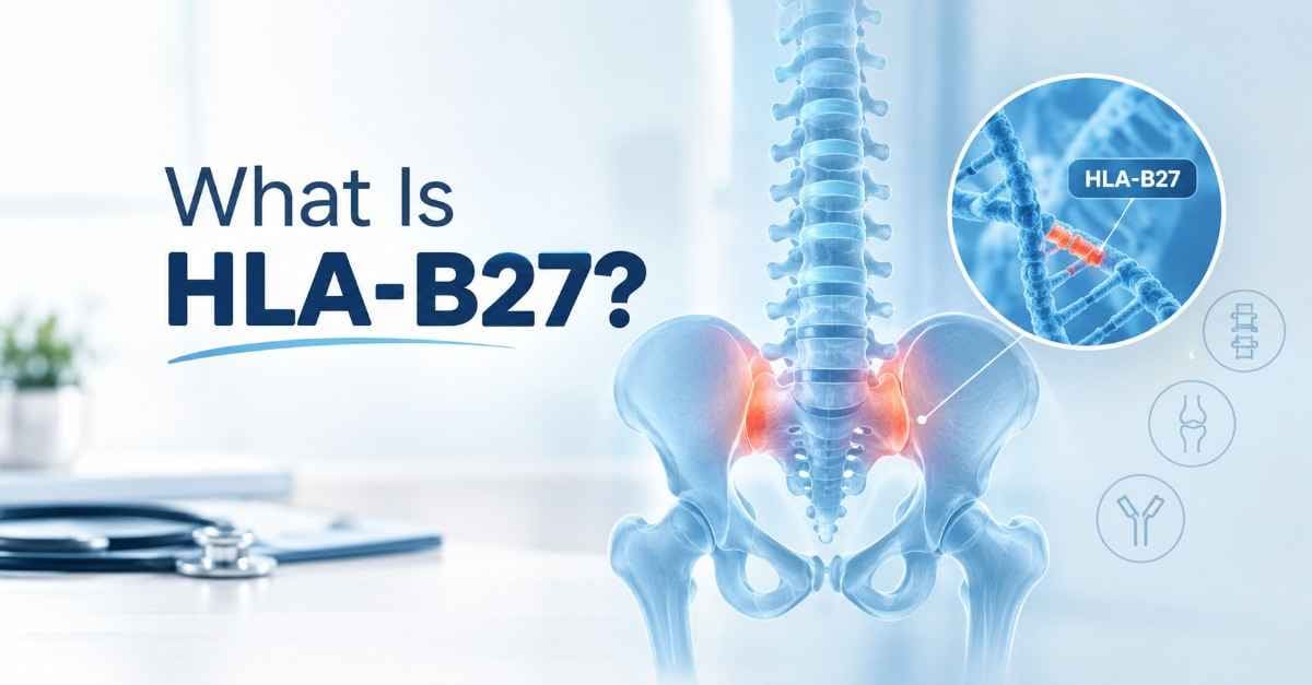 What Is HLA-B27?
